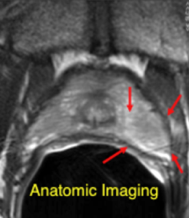 anatomic imaging