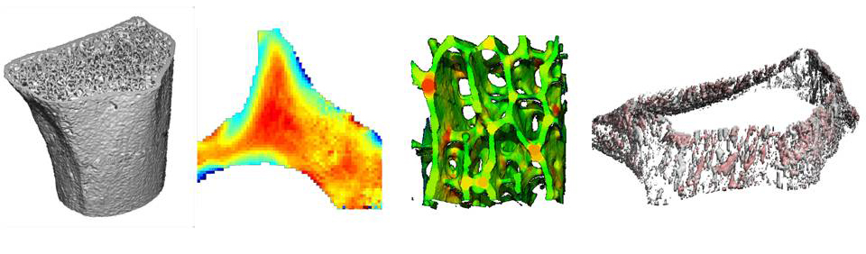Bone Quality Research - microCT, HR-pQCT, and Fourier transform infrared (FTIR) spectroscopy