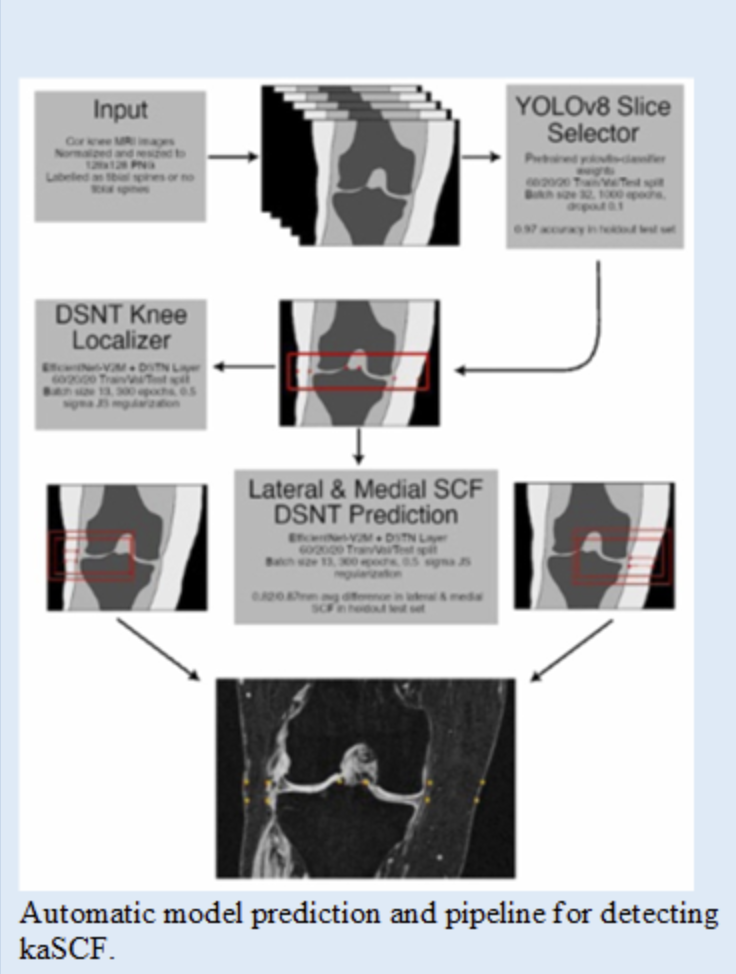 Diagram illustrating an automated deep learning pipeline for detecting knee adjacent subchondral cystic formations from MRI, showing steps from image input and slice selection to knee localization and lateral and medial prediction, with example bounding boxes and final MRI output highlighting detected regions.