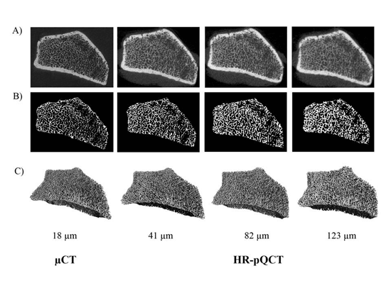 Comparison of bone images across imaging resolutions, showing trabecular bone structure in micro CT and HR pQCT at increasing voxel sizes, illustrating how image detail decreases as resolution becomes coarser.