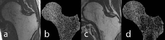 MRI and high resolution bone images showing femoral bone and marrow structure, with paired panels comparing anatomical imaging and detailed trabecular bone architecture.