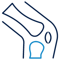 Simplified icon of the prostate gland highlighting targeted treatment areas.