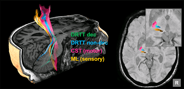 brain imaging image
