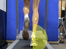 Rear view of a runner on a treadmill with motion capture markers and a highlighted area indicating peak ankle eversion during stance phase.