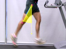 Side view of a runner with motion capture markers and a highlighted angle illustrating peak thigh extension during gait.