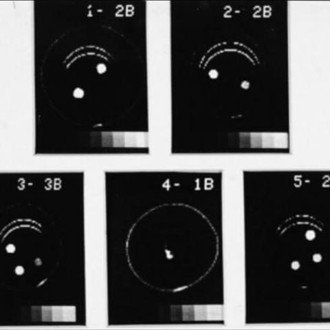 1975:  Having proved the usefulness of CT scanning, the UCSF Department of Radiology funded a small R&D operation, tasking engineers and physicists with developing nuclear magnetic resonance (later known as MRI) as a viable imaging instrument for soft tissues.