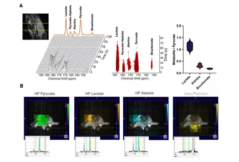 Metabolic MRI data visualizations showing pyruvate and lactate signals with corresponding imaging overlays
