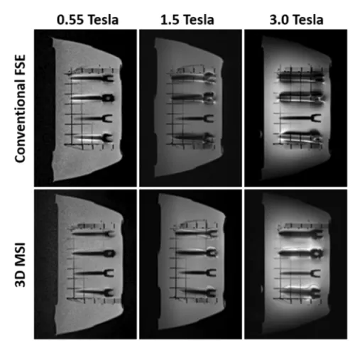 Six-panel MRI comparison showing images of a vascular stent phantom acquired at 0.55, 1.5, and 3.0 Tesla. The top row shows conventional FSE imaging and the bottom row shows 3D MSI, illustrating differences in image artifacts and visualization across magnetic field strengths and imaging techniques.