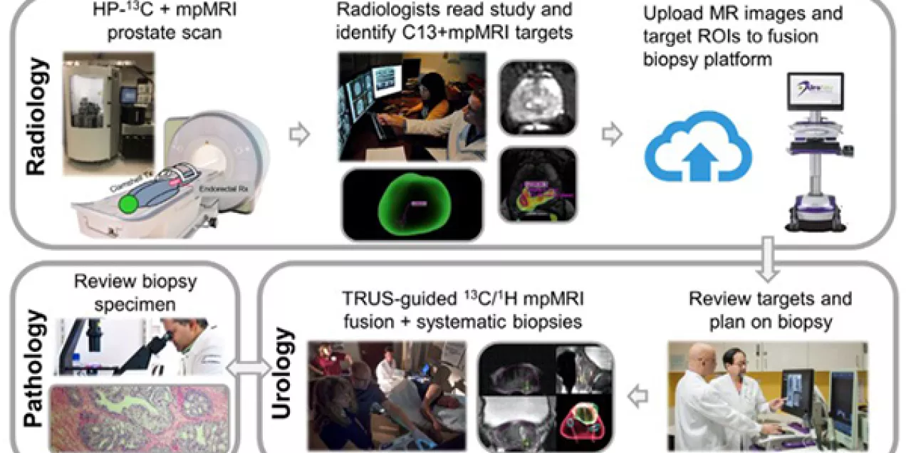 HP C-13 multiparametric MRI Prostate Cancer Biopsy Guidance Workflow.