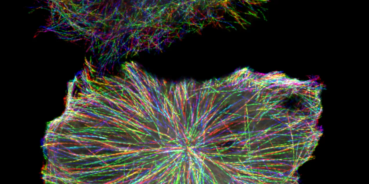 Close-up of multicolor imaging data representing complex biological or radiotracer distribution patterns