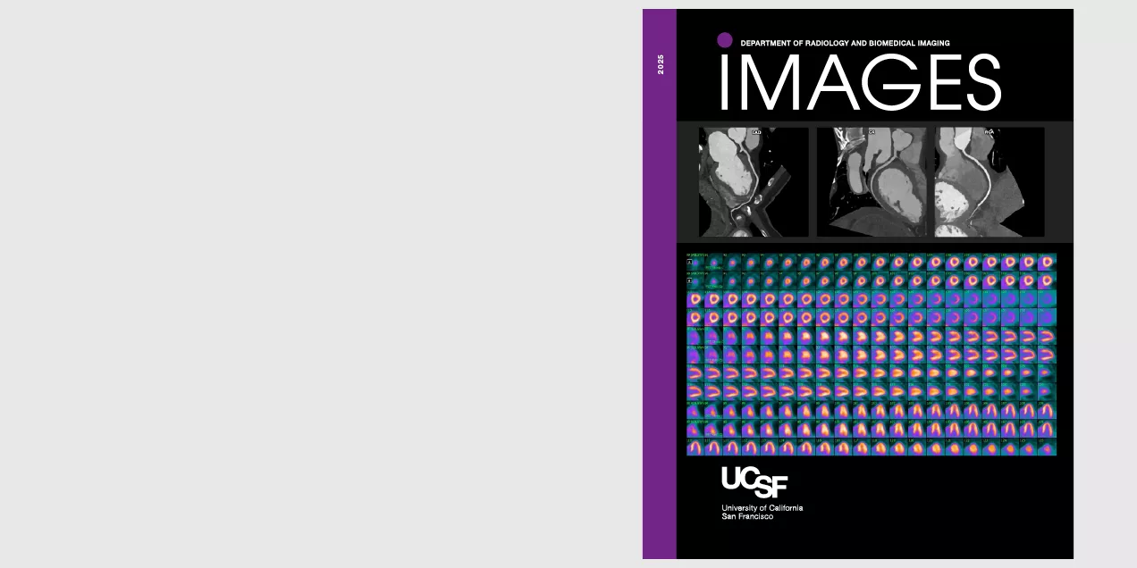 Black cover design for UCSF Department of Radiology and Biomedical Imaging titled “IMAGES” with a vertical purple sidebar labeled 2025. The layout features grayscale cardiac CT scans across the top and a large grid of colorful nuclear medicine or PET scan slices below. UCSF logo and “University of California San Francisco” appear at the bottom.