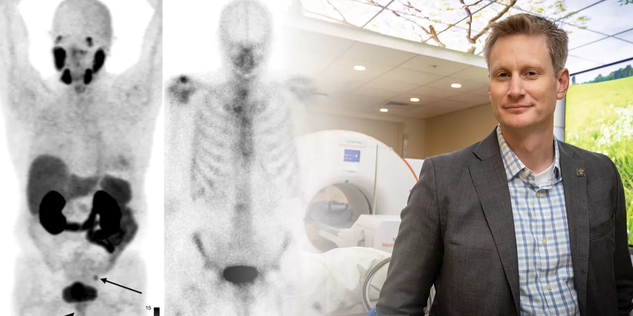 Thomas Hope, MD stands in a medical imaging suite next to a PET/CT scanner, with PSMA PET and bone scan images displayed alongside him, illustrating imaging methods used to stage prostate cancer.