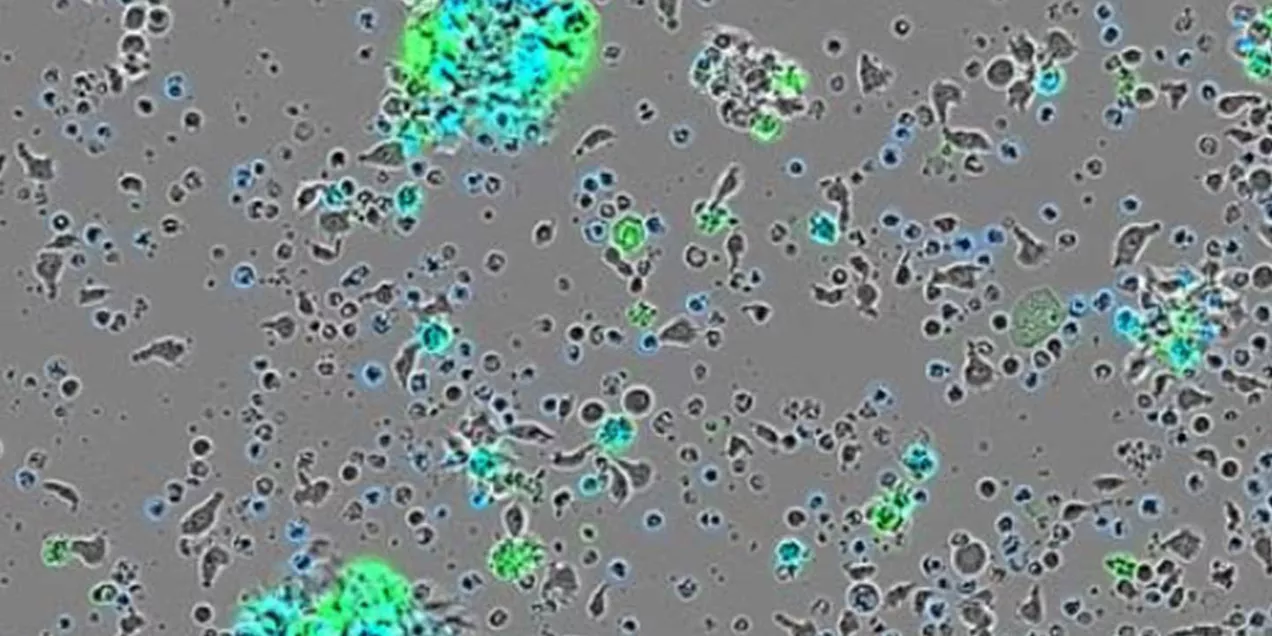 A microscope image of tumor cells where scattered clusters glow with bright green and turquoise highlights, representing the accumulation of radioactive antibodies.