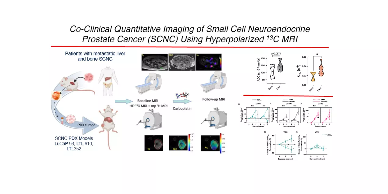 Multi-panel figure demonstrating hyperpolarized (HP) ^13C MRI of a small-cell neuroendocrine prostate cancer model. Panel A shows an anatomical MR image with selected slices, dynamic ^13C spectra over time identifying lactate, pyruvate-hydrate, alanine, pyruvate, and bicarbonate peaks, a time-resolved spectral plot, and violin plots of metabolite-to-pyruvate ratios. Panel B shows axial anatomical MR images overlaid with spatial maps of HP pyruvate, lactate, and alanine signals, alongside a urea phantom refe