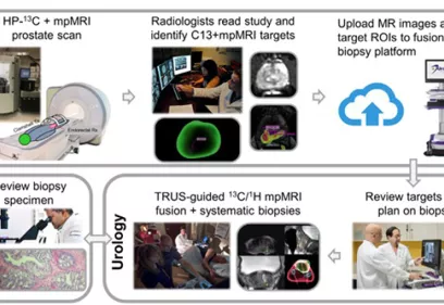 HP C-13 multiparametric MRI Prostate Cancer Biopsy Guidance Workflow.