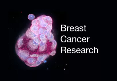 3D medical visualization of a breast tissue structure rendered in vivid pink and blue tones against a black background, representing breast cancer research. To the right, white text reads “Breast Cancer Research.”