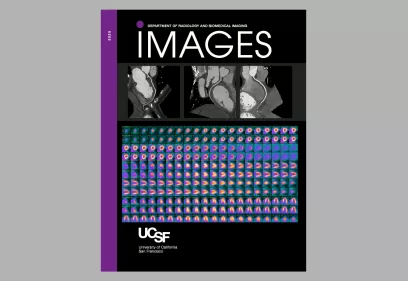 IMAGES magazine cover from the UCSF Department of Radiology and Biomedical Imaging. The design features a black background with a vertical purple sidebar on the left labeled “VOL 5.” Across the top are grayscale medical imaging scans showing cross-sectional views of the human body. Below, a colorful grid of brain imaging slices in vibrant blues, pinks, and yellows creates a striking contrast. The UCSF logo and “University of California San Francisco” appear at the bottom.