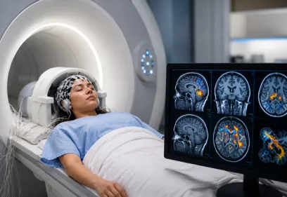 Patient undergoing an MRI examination while wearing an EEG monitoring cap with multiple electrodes and wires attached to the scalp. The patient lies comfortably on the MRI table as a nearby monitor displays detailed brain images with highlighted areas of activity. The combined MRI and EEG setup is used to evaluate brain function and help diagnose neurological conditions such as epilepsy.