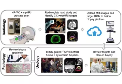Workflow diagram illustrating a multidisciplinary prostate cancer imaging and biopsy process involving radiology, urology, and pathology. The top row shows MRI and hyperpolarized carbon-13 imaging, radiologist review and target identification, and transfer of imaging data to a biopsy platform. The lower sections depict biopsy planning, image-guided prostate biopsies, pathology review of tissue samples, and coordination between specialists. Arrows connect each step to show the progression from imaging to bio