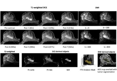 Alt text: Figure showing breast MRI scans and analysis maps used to evaluate a breast tumor and predict treatment response.