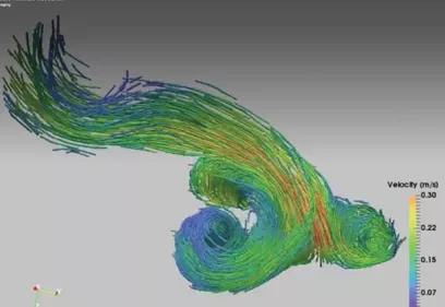 Scientific visualization of blood flow dynamics within a blood vessel. Color-coded streamlines illustrate the direction and velocity of flow, with blue, green, yellow, and red colors representing different speeds. The image demonstrates advanced imaging and computational modeling used to study vascular conditions and blood flow patterns.