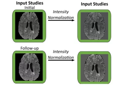 Diagram illustrating an image-processing workflow for brain MRI studies. Initial and follow-up brain scans are shown on the left, with arrows labeled "Intensity Normalization" pointing to corresponding processed images on the right. The figure demonstrates how image intensity is standardized between scans to improve consistency for comparison and analysis over time.