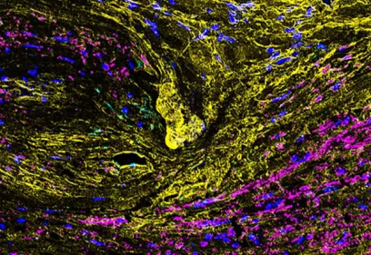 Fluorescent microscope image of a cross-section of a brain aneurysm.
