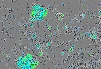 A microscope image of tumor cells where scattered clusters glow with bright green and turquoise highlights, representing the accumulation of radioactive antibodies.