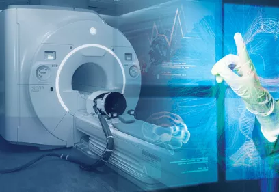 Stylized graphic of an MRI scanner overlaid with a translucent blue illustration of a human brain and neural network patterns, representing the use of artificial intelligence in medical imaging and radiology.