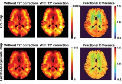 Comparison of color-coded brain imaging maps showing results without and with T2* correction for kPL and lactate-to-pyruvate measurements. Fractional difference maps on the right illustrate changes between the corrected and uncorrected images, with color scales indicating relative values.