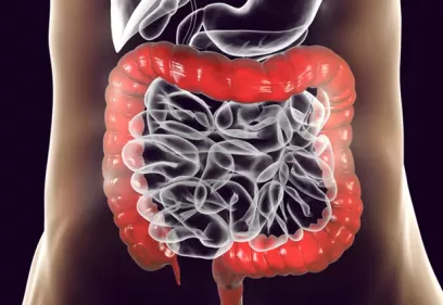 A medical illustration of the human digestive system highlighting the large intestine in red. The colon surrounds the smaller intestines, which are shown in a translucent gray, demonstrating the anatomy of the lower gastrointestinal tract.