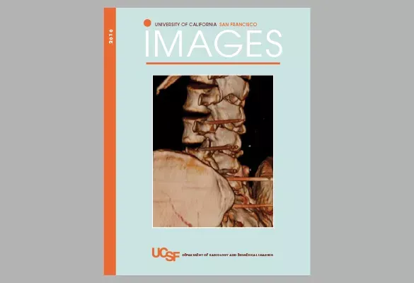 2010: IMAGES cover with a 3D spinal imaging scan centered on a light background.