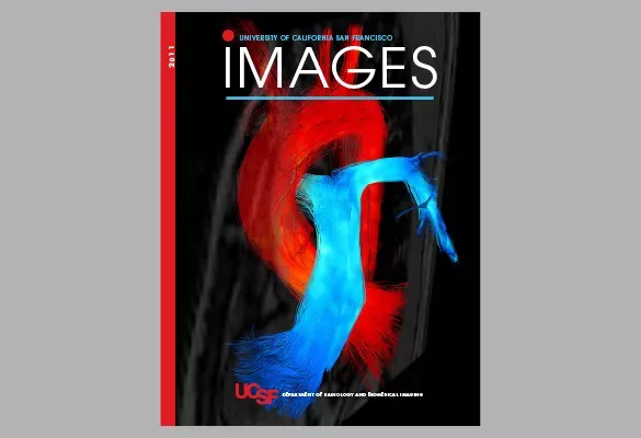 2011: IMAGES cover featuring a heart and major vessel in contrasting red and blue tones.