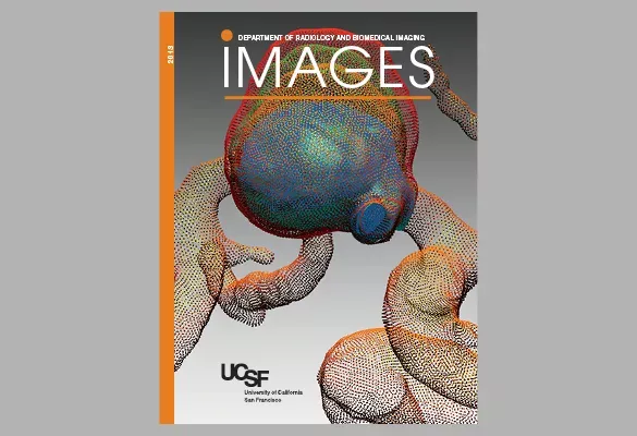 2013 IMAGES cover featuring a 3D anatomical rendering of a joint or bone structure in orange and blue tones.