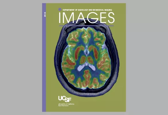 2014: IMAGES cover with a brain scan in green, yellow, and red on a muted background.