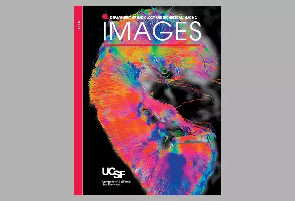 2015: IMAGES cover showing a heart with multicolored fiber tract visualization in bright neon tones.