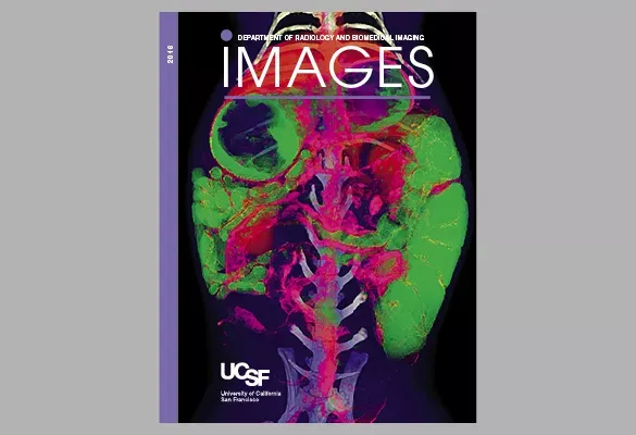 2016: IMAGES cover featuring a colorful head and neck scan with vivid pink, green, and purple anatomical