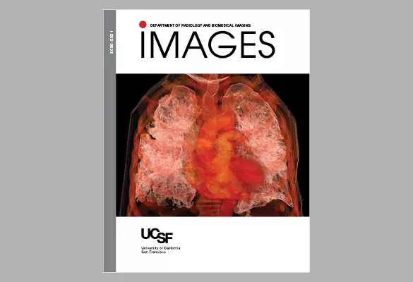 2020–2021: IMAGES cover featuring a detailed chest and lung scan in warm red and orange tones on a white