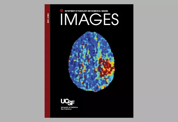 2021–2022: IMAGES cover with a brain scan in blue tones with highlighted regions in red and yellow.