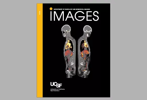 2024: IMAGES magazine cover featuring two full-body medical scans side by side with highlighted internal activity in warm colors on a black background.