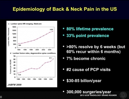 Embedded thumbnail for The Prevalence of Back Pain