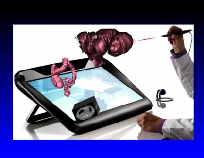 Embedded thumbnail for New Ways to See the Colon 