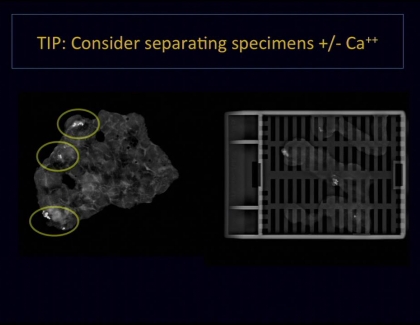 Embedded thumbnail for Breast Imaging: Radiology-Pathology Correlation