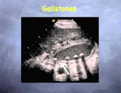Embedded thumbnail for What can we see with ultrasound?