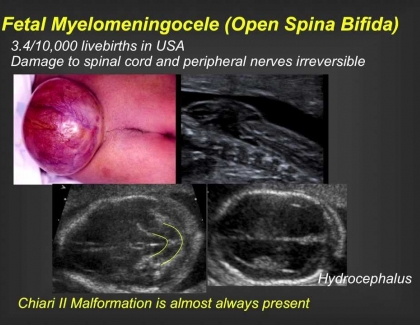 Embedded thumbnail for Operating in the Womb