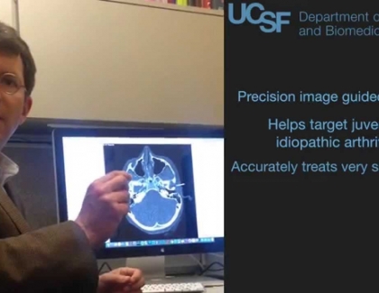Embedded thumbnail for How does UCSF treat juvenile idiopathic arthritis?