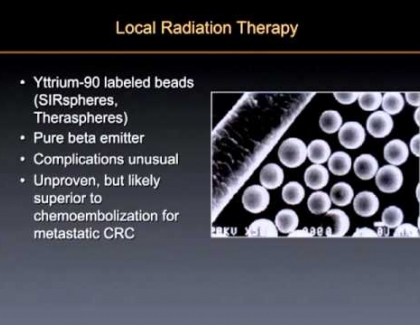 Embedded thumbnail for How do interventional radiologists use radio embolization?