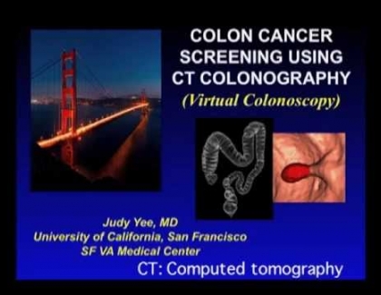 Embedded thumbnail for Why is it important to screen for colon cancer?