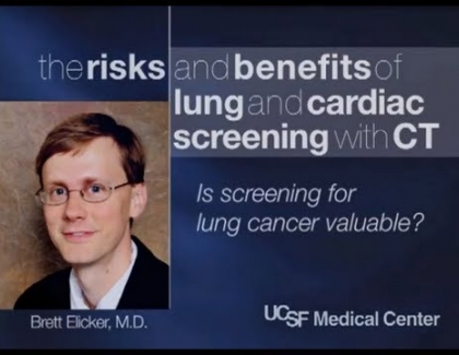 Embedded thumbnail for Is screening for lung cancer valuable?