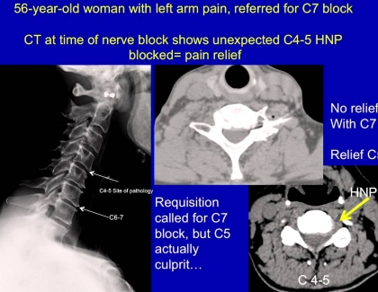 Embedded thumbnail for Visualizing Other Causes of Back Pain